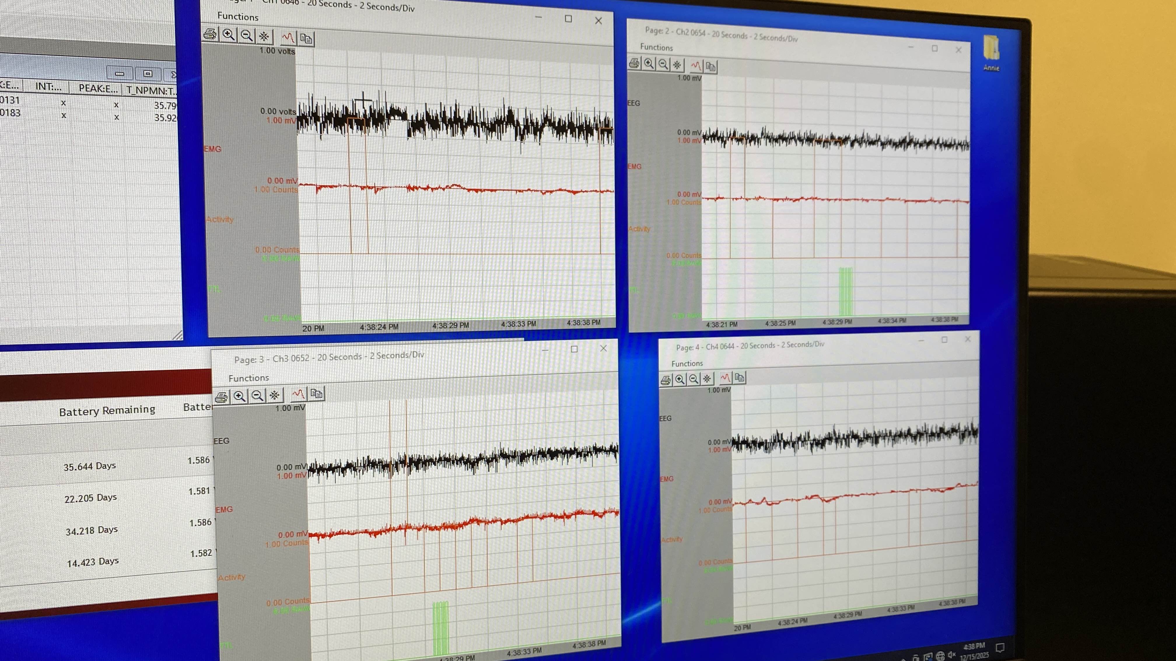 EEG paired output