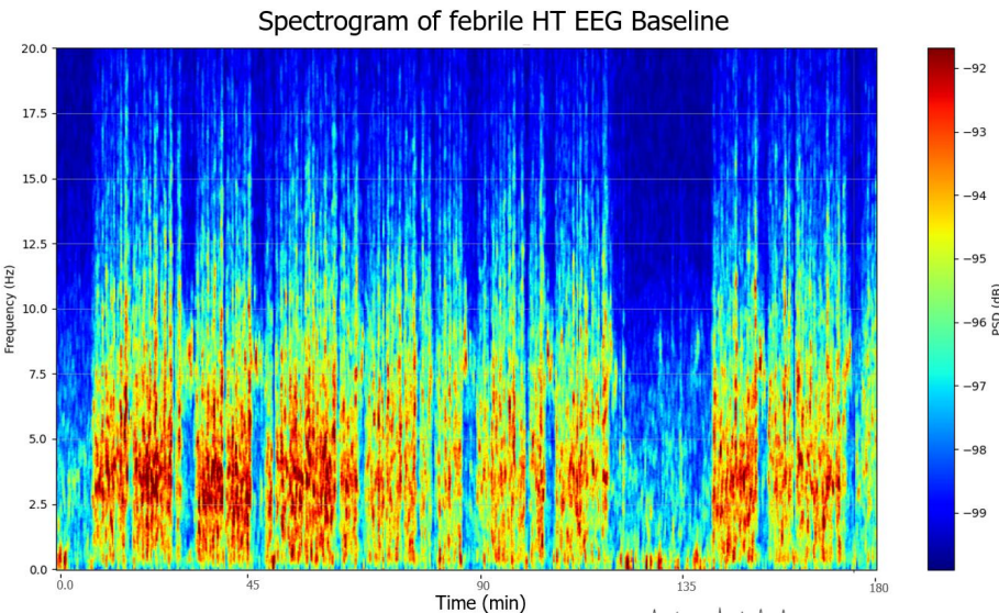 spectrogram