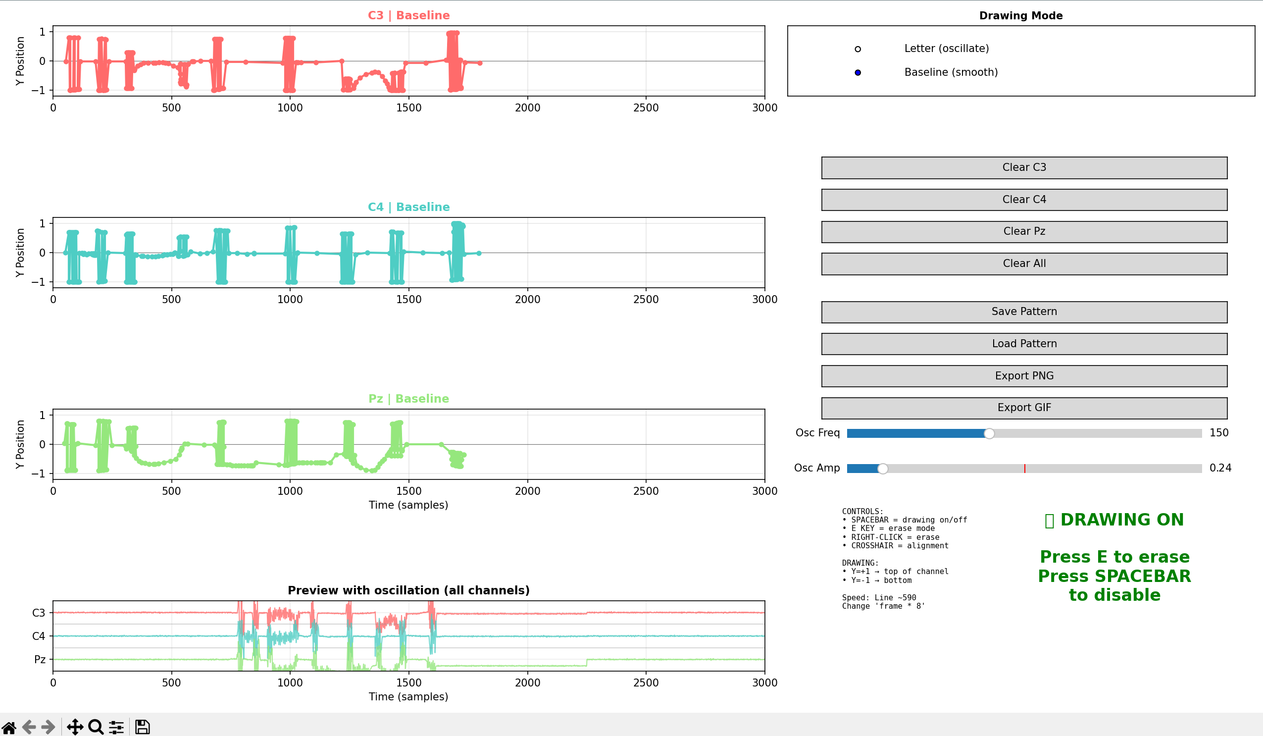RC Circuit of EEG analog signal processing component